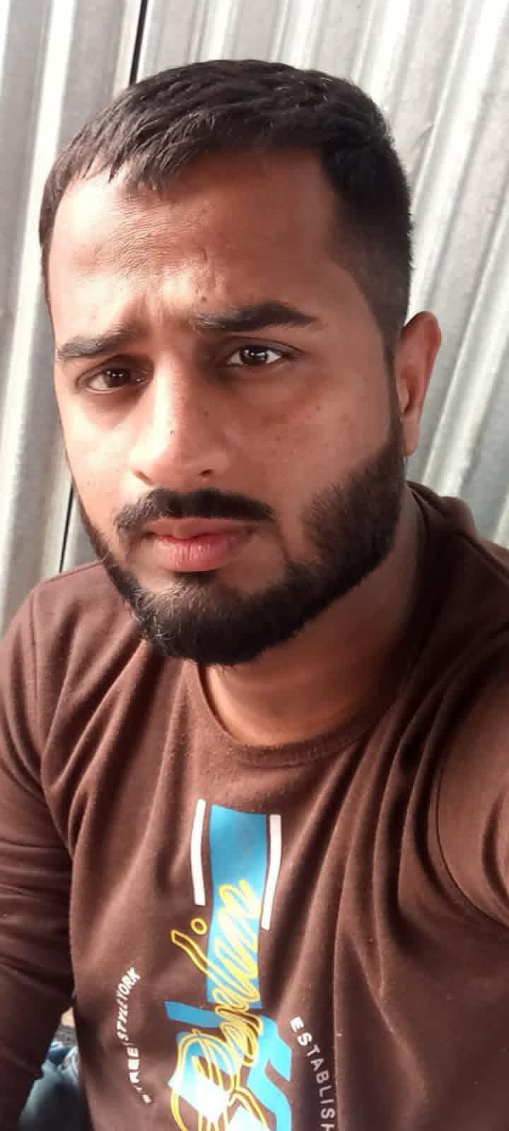 Front Hair Line Restored — before FUE Chinese Method